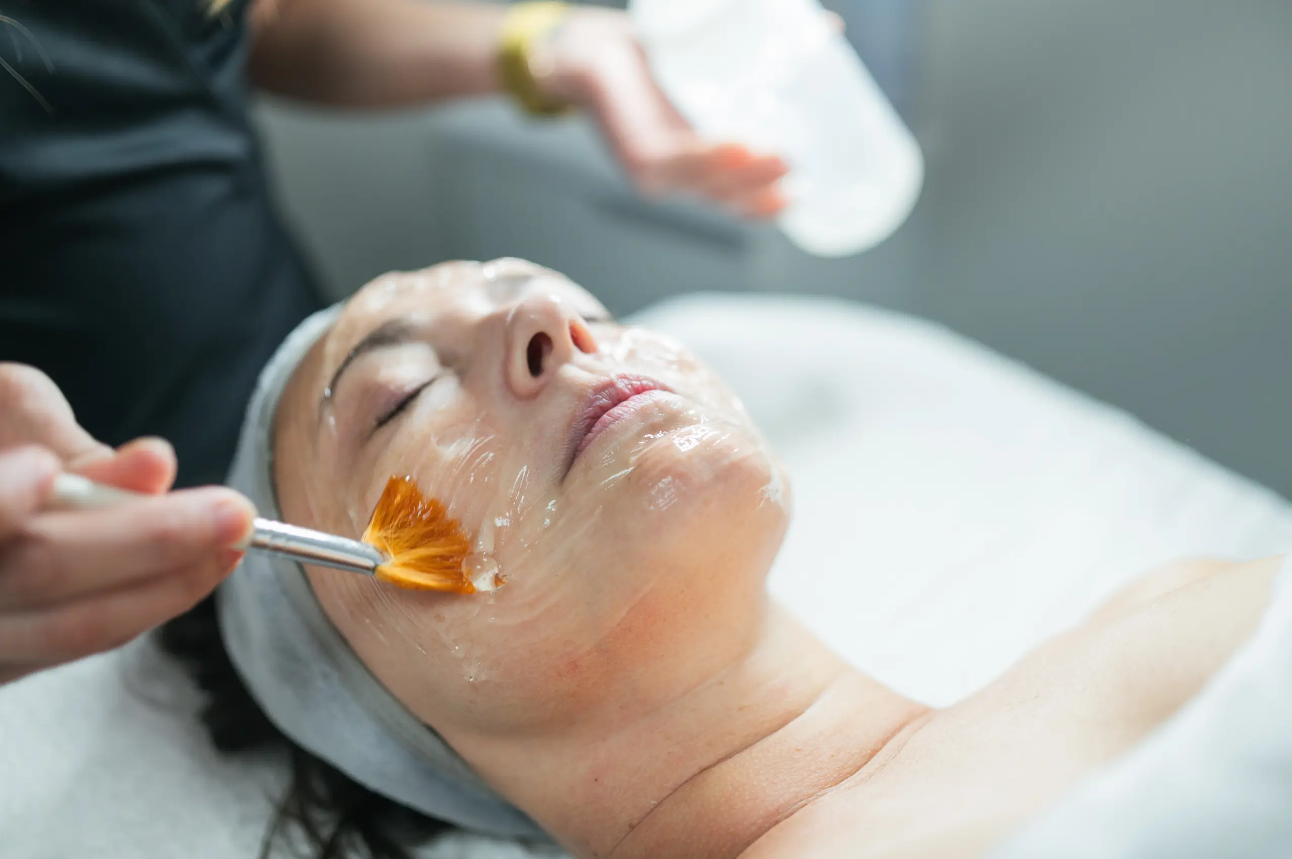 Chemical Peel Treatment