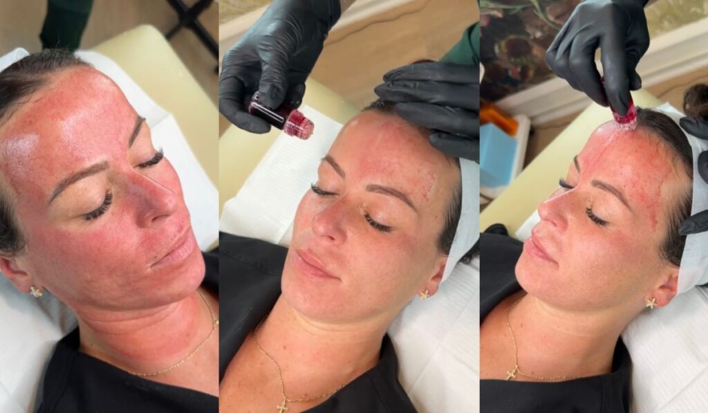 The EVRI Botox Facial at Delaware's best med spa
